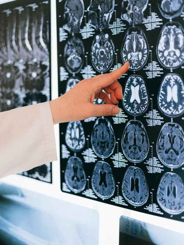 This Is Your Brain Under&nbsp;Anesthesia