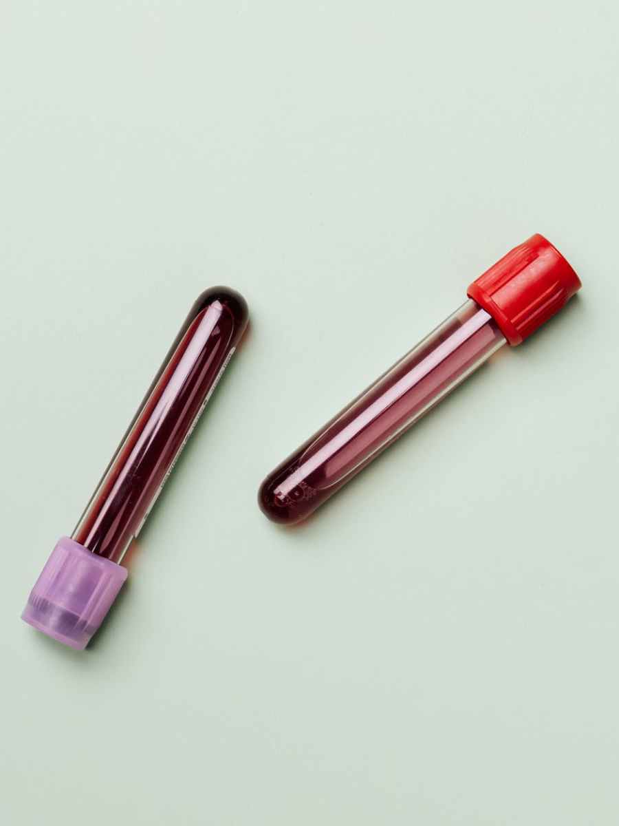 This Protein Predicts a Brain’s Future after Traumatic&nbsp;Injury