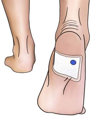 This Plastic Dot Sniffs Out Infections Doctors Can’t&nbsp;See