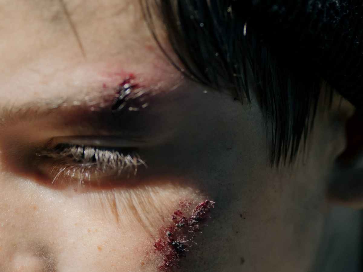 These Nanobots Can Swim Around a Wound and Kill&nbsp;Bacteria