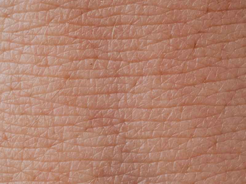 Rewiring cell communication to treat&nbsp;melanoma