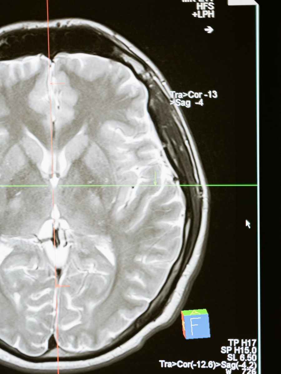 Why Antidepressants Take So Long to&nbsp;Work