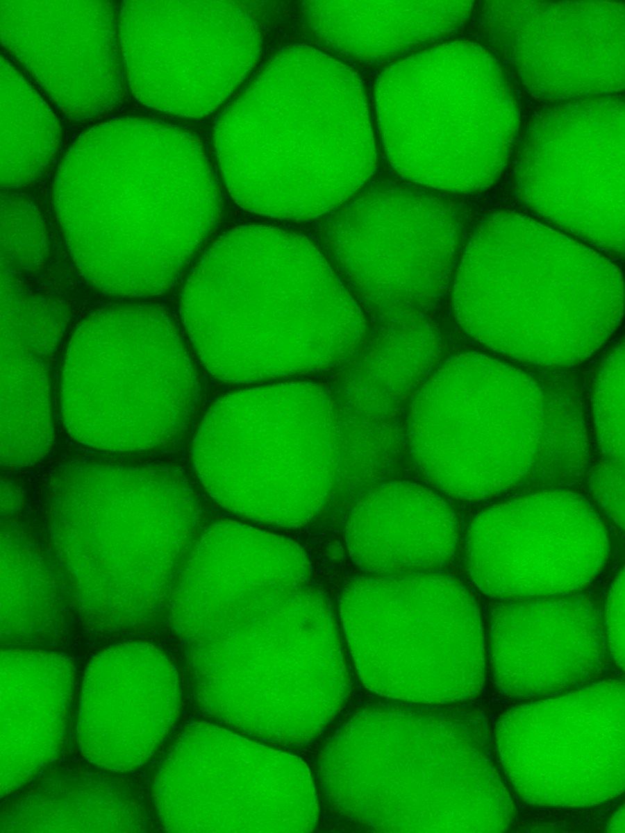 These Newly Identified Cells Could Change the Face of Plastic&nbsp;Surgery