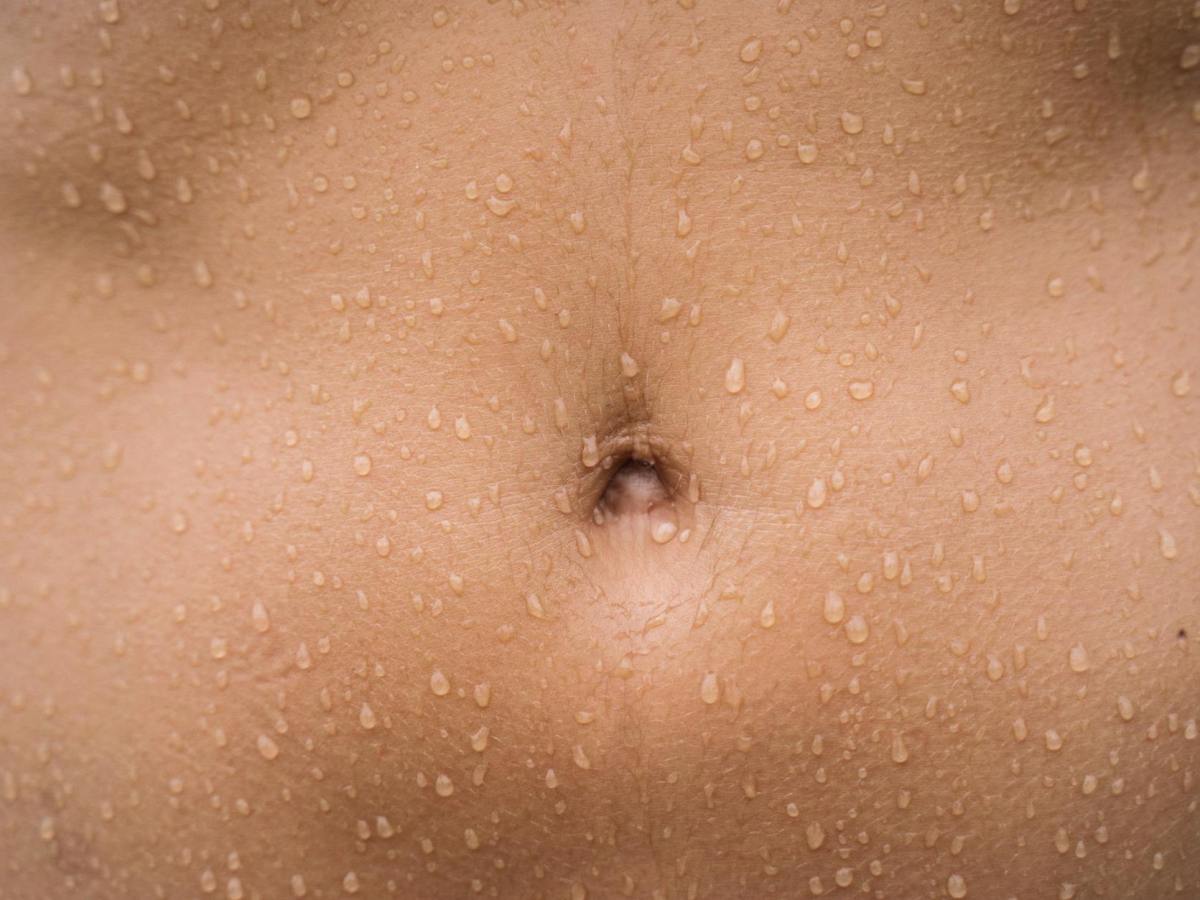 An evolving answer to excess&nbsp;sweating
